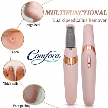 Electric Foot Callus Remover – Rechargeable Pedicure Tool for Smooth & Crack-Free Feet