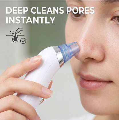 PoreVac blackhead remover